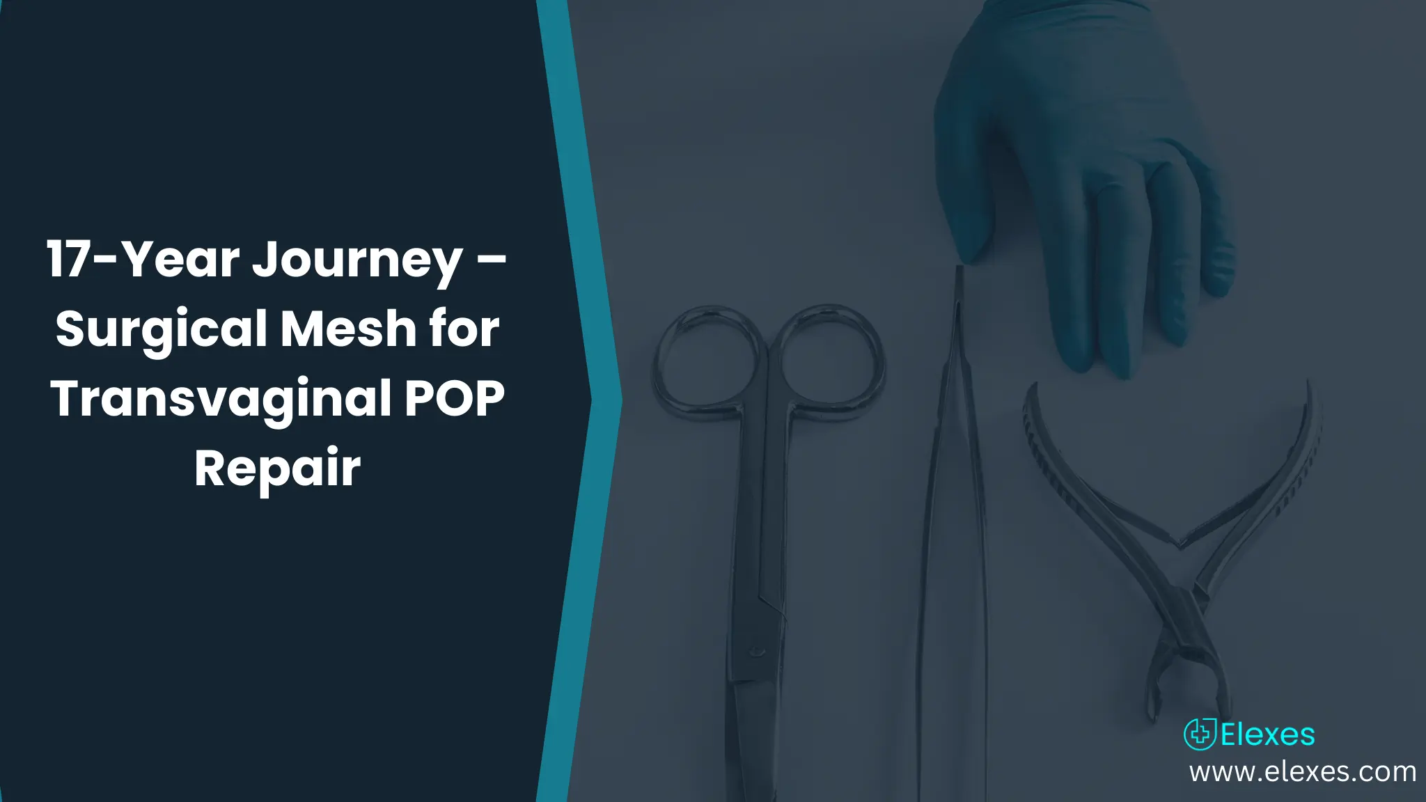 17 years Journey – Surgical Mesh for Transvaginal Repair of Pelvic Organ Prolapse (POP)